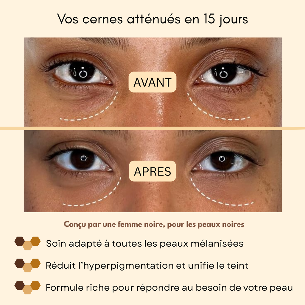 Patchs yeux au curcuma