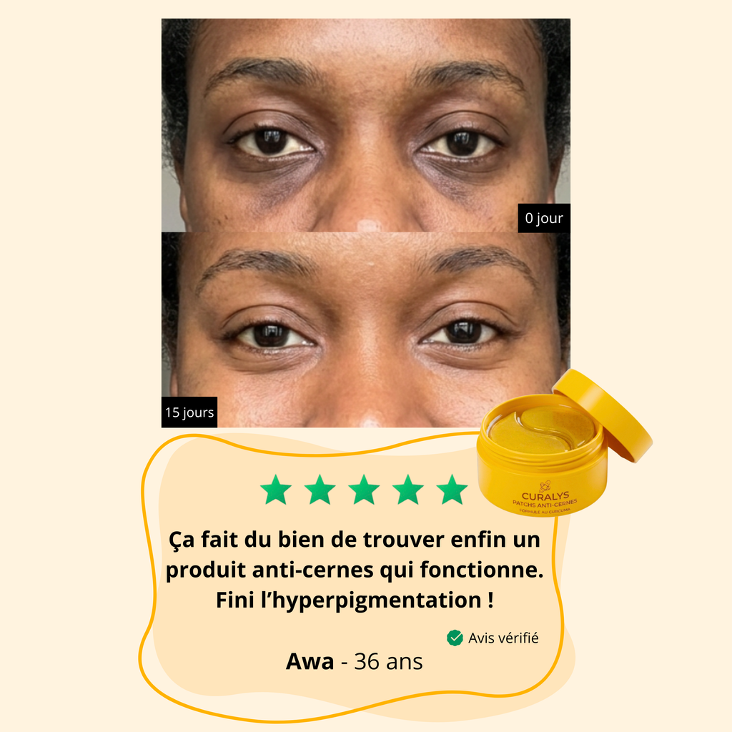 Patchs yeux au curcuma